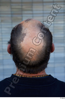 Street  733 bald hair head 0001.jpg